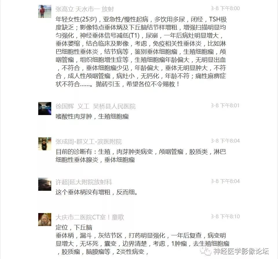 【病例】下丘脑节细胞胶质瘤一例MR影像表现