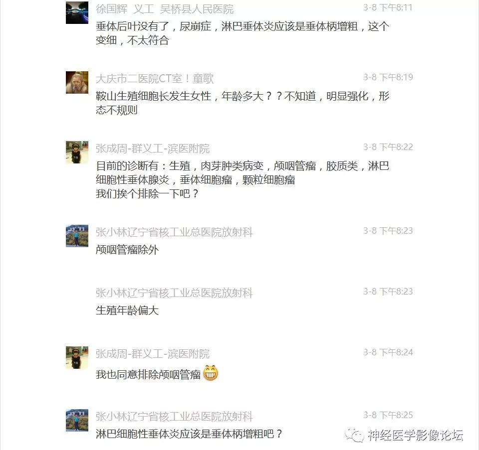 【病例】下丘脑节细胞胶质瘤一例MR影像表现