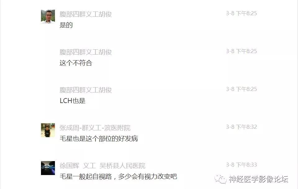 【病例】下丘脑节细胞胶质瘤一例MR影像表现