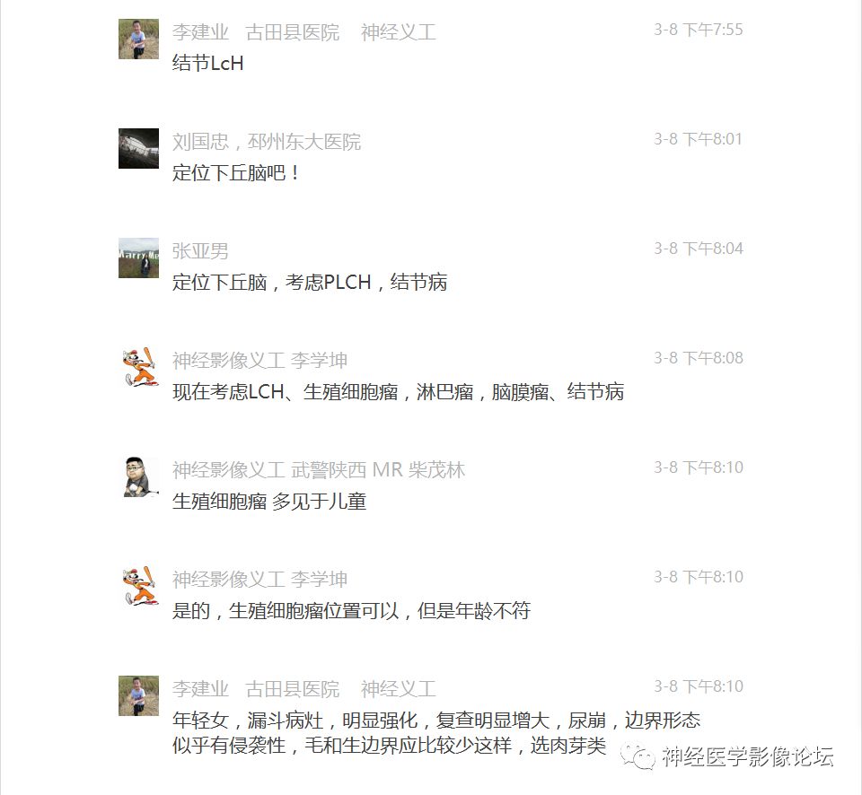 【病例】下丘脑节细胞胶质瘤一例MR影像表现