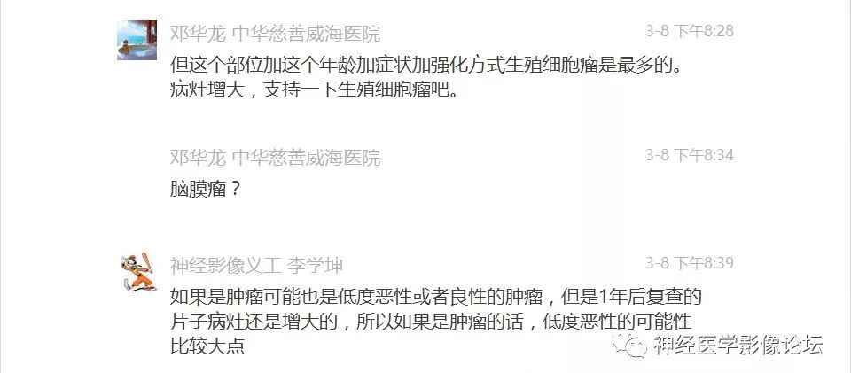 【病例】下丘脑节细胞胶质瘤一例MR影像表现