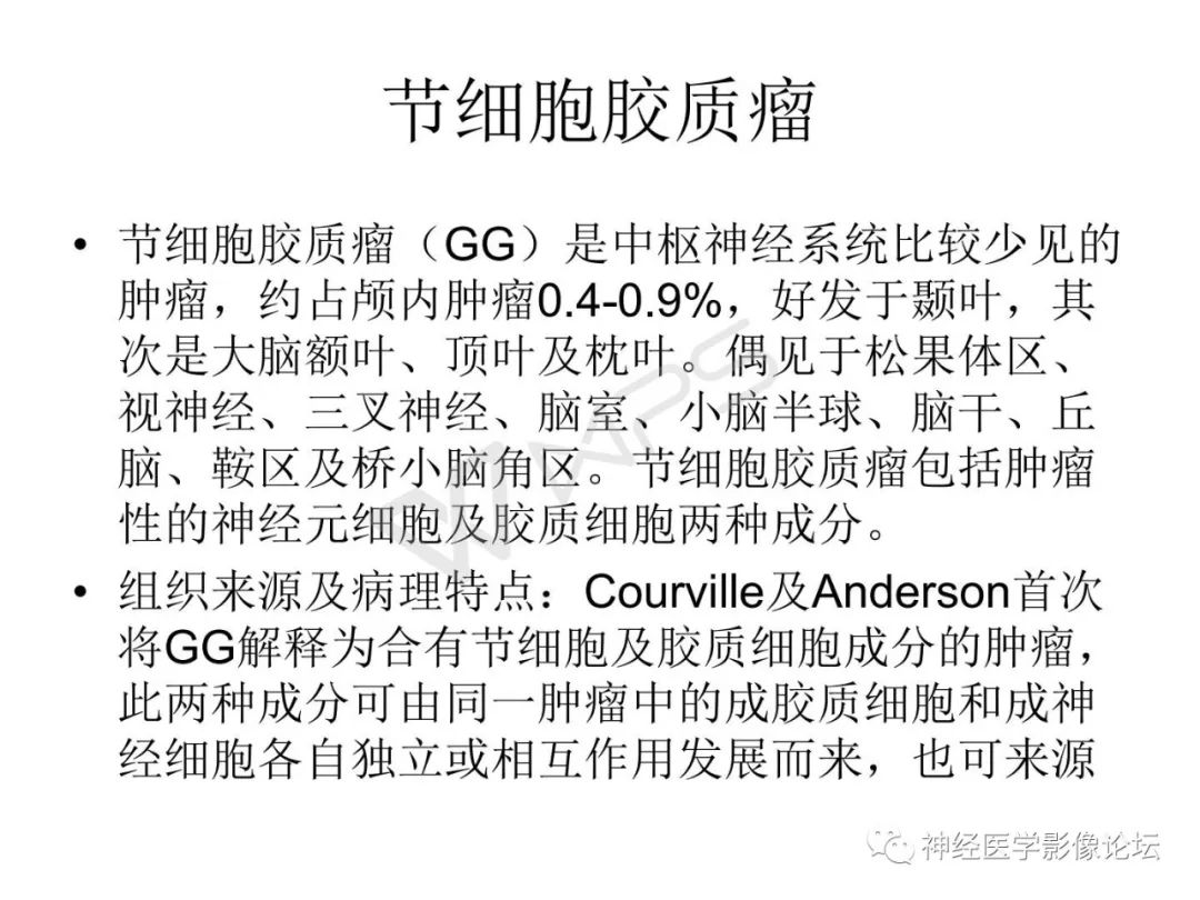 【病例】下丘脑节细胞胶质瘤一例MR影像表现