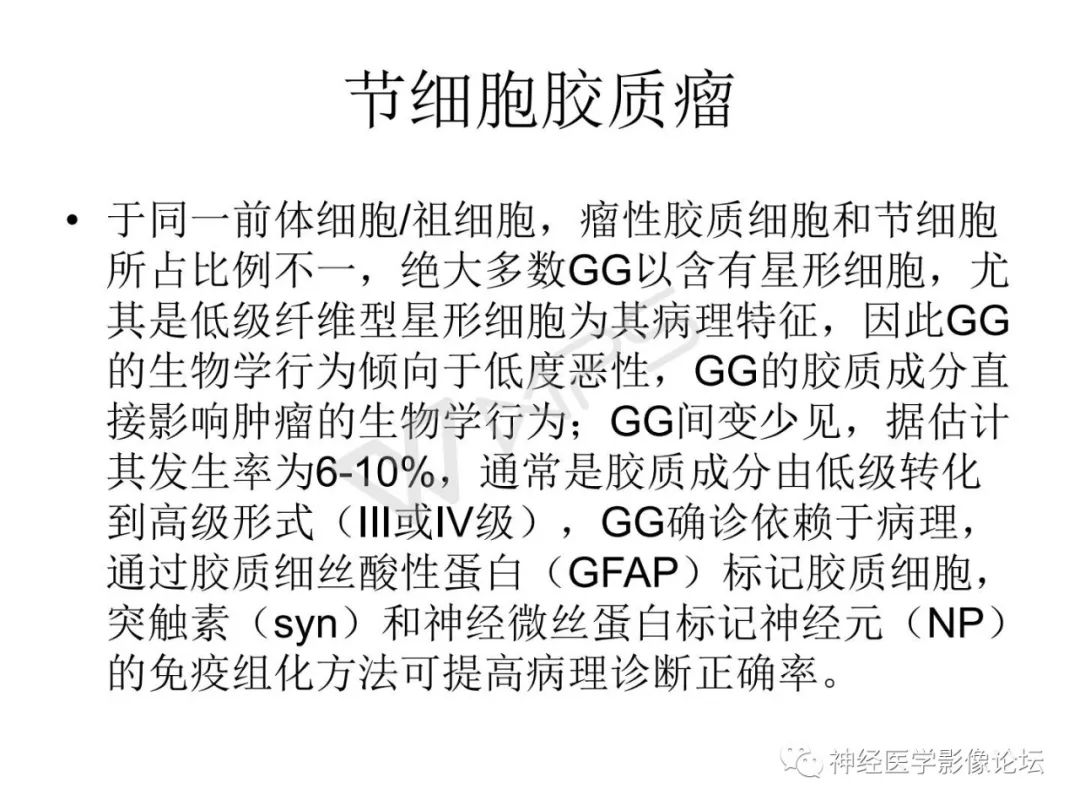 【病例】下丘脑节细胞胶质瘤一例MR影像表现