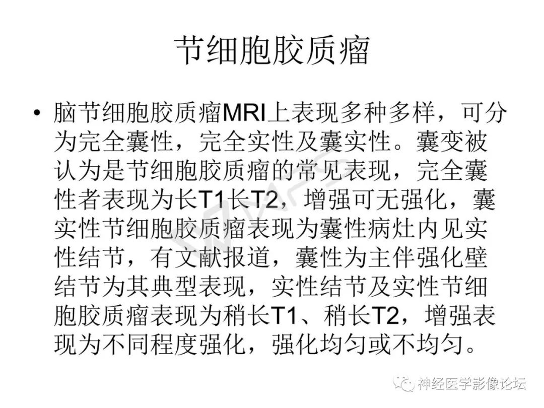 【病例】下丘脑节细胞胶质瘤一例MR影像表现
