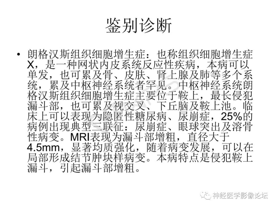 【病例】下丘脑节细胞胶质瘤一例MR影像表现
