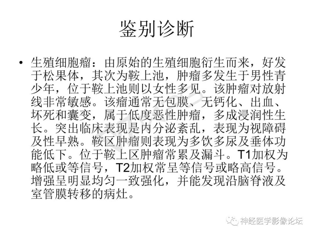 【病例】下丘脑节细胞胶质瘤一例MR影像表现