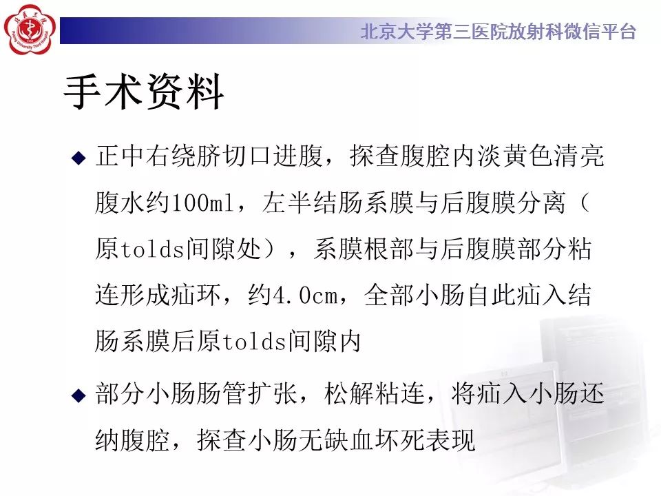 【病例】十二指肠旁疝1例CT影像表现