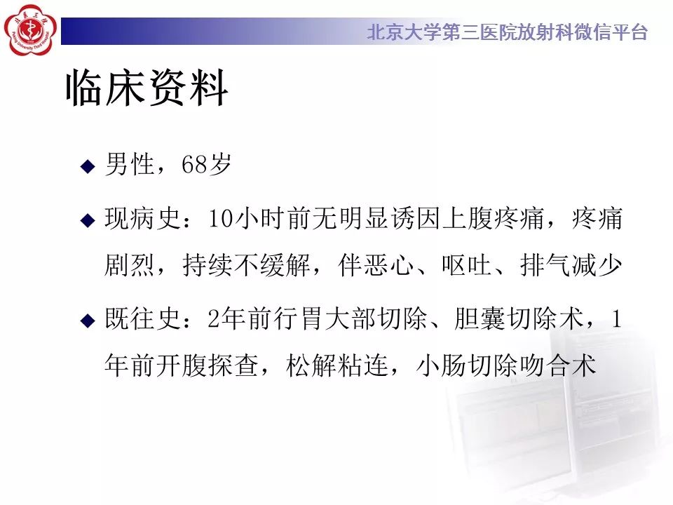 【病例】十二指肠旁疝1例CT影像表现