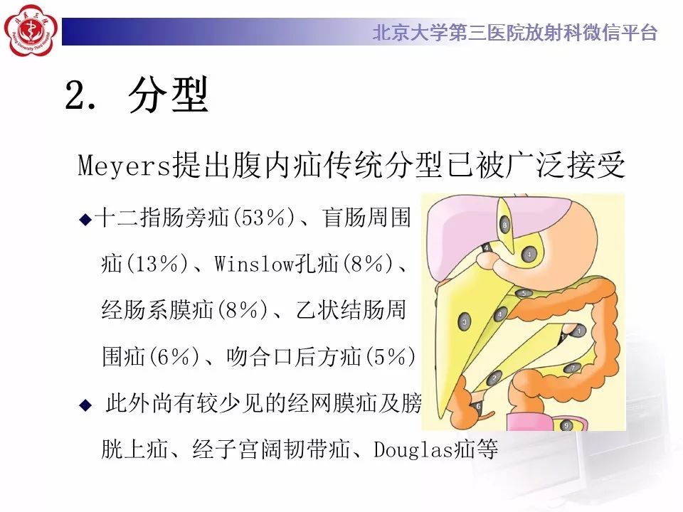 【病例】十二指肠旁疝1例CT影像表现