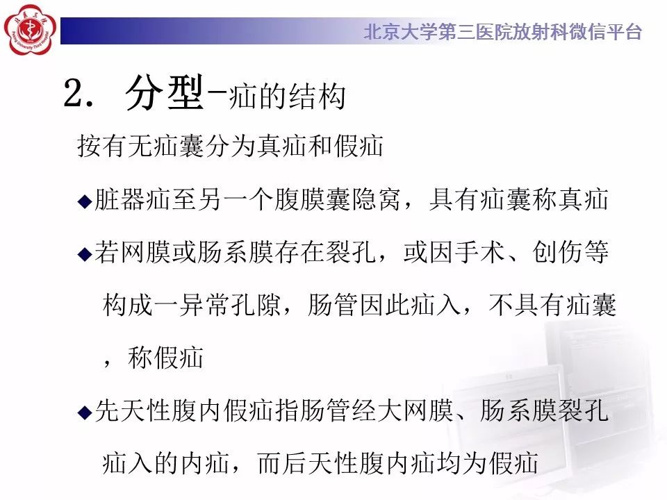 【病例】十二指肠旁疝1例CT影像表现