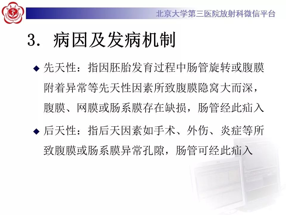 【病例】十二指肠旁疝1例CT影像表现