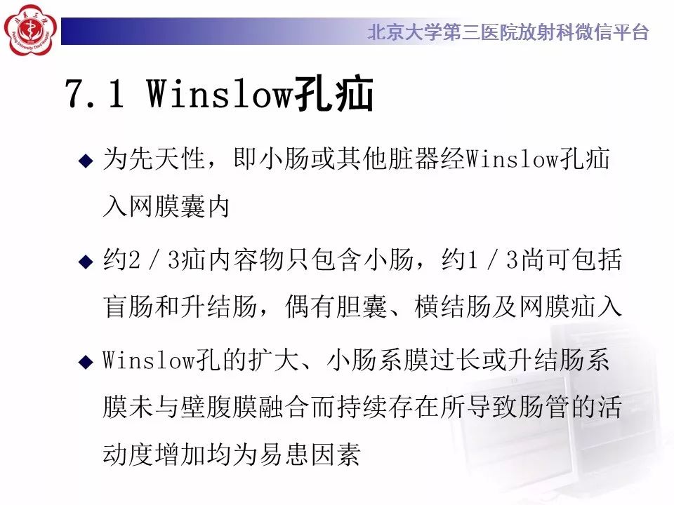 【病例】十二指肠旁疝1例CT影像表现