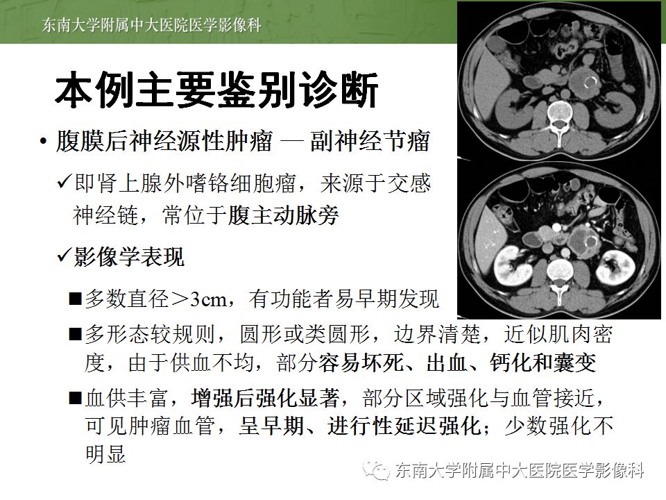【病例】肾脏病例随访读片CT 【病例】肾脏病例随访读片CT