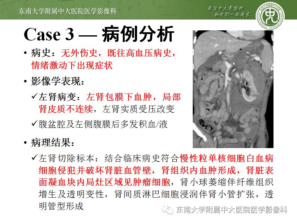 【病例】肾脏病例随访读片CT 【病例】肾脏病例随访读片CT