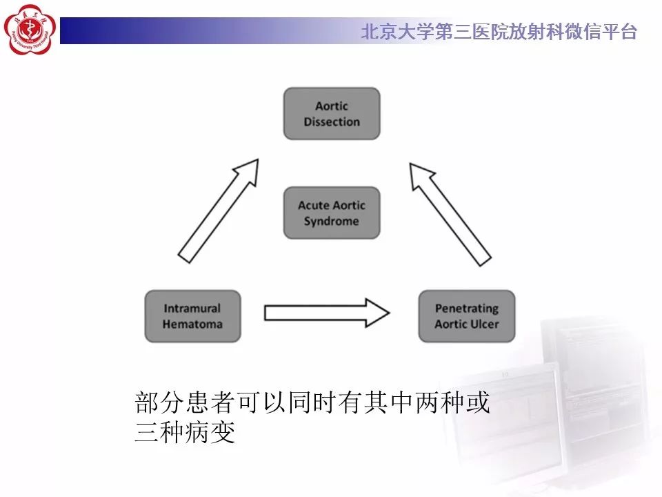 【PPT】急性动脉综合征