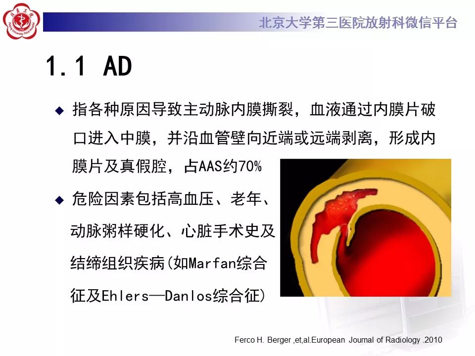 【PPT】急性动脉综合征