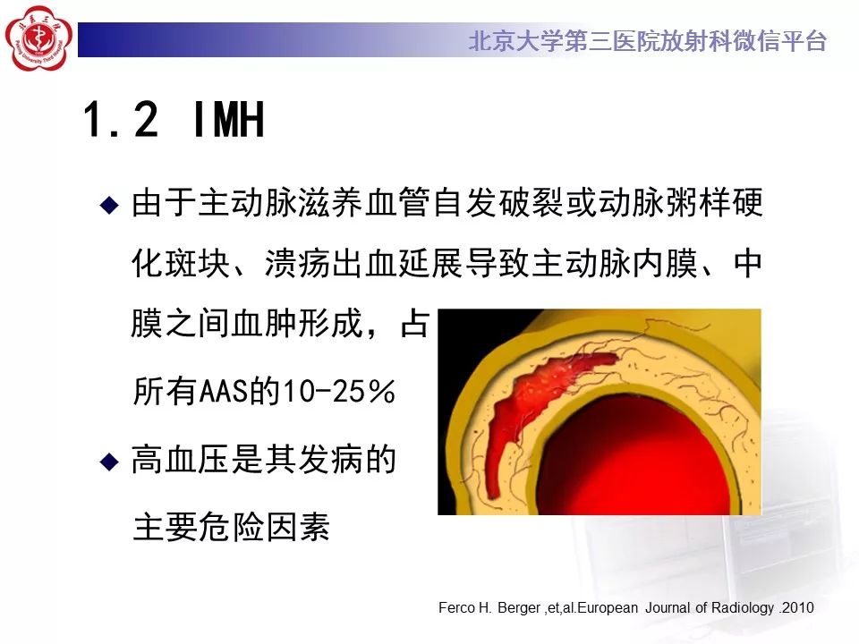 【PPT】急性动脉综合征