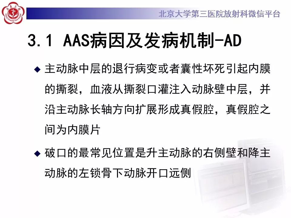 【PPT】急性动脉综合征