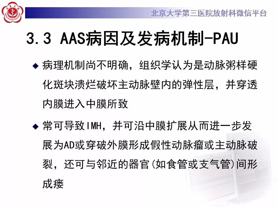 【PPT】急性动脉综合征