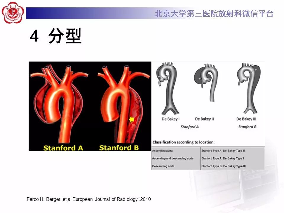【PPT】急性动脉综合征