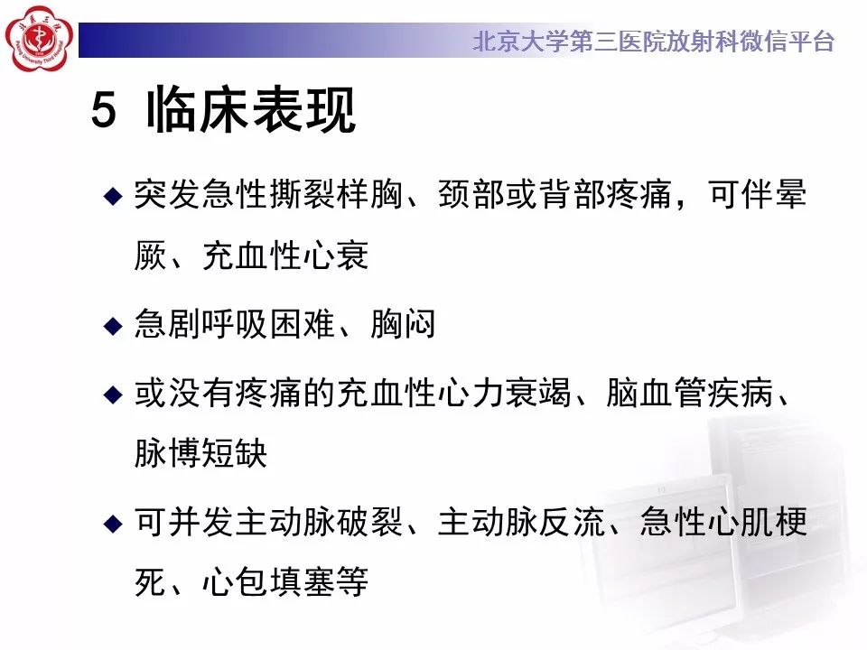 【PPT】急性动脉综合征
