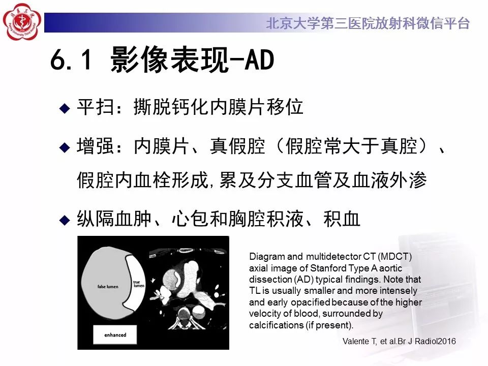 【PPT】急性动脉综合征