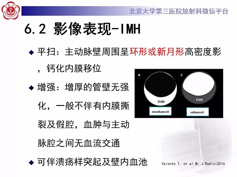 【PPT】急性动脉综合征