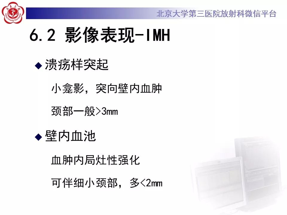 【PPT】急性动脉综合征