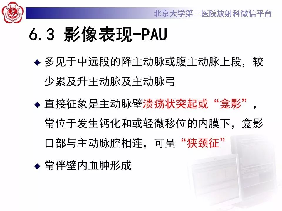 【PPT】急性动脉综合征
