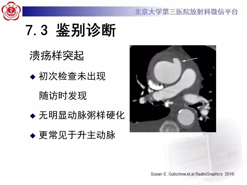 【PPT】急性动脉综合征
