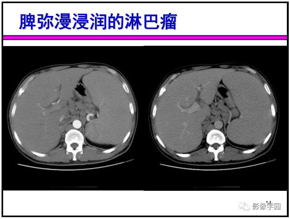 【PPT】