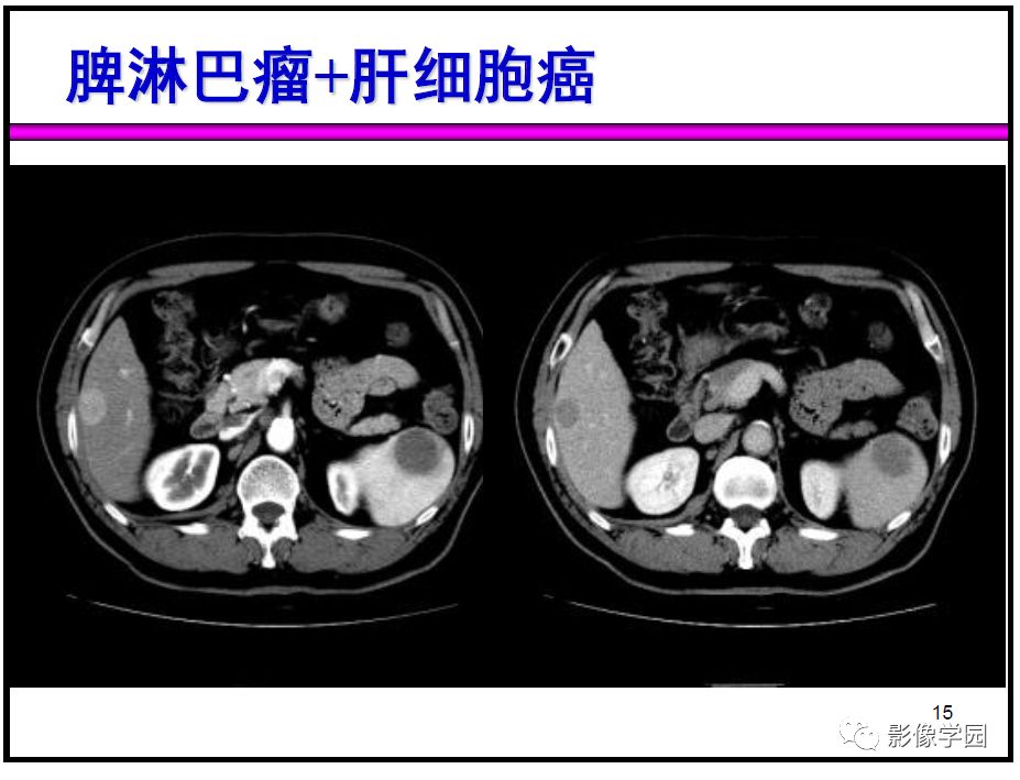 【PPT】
