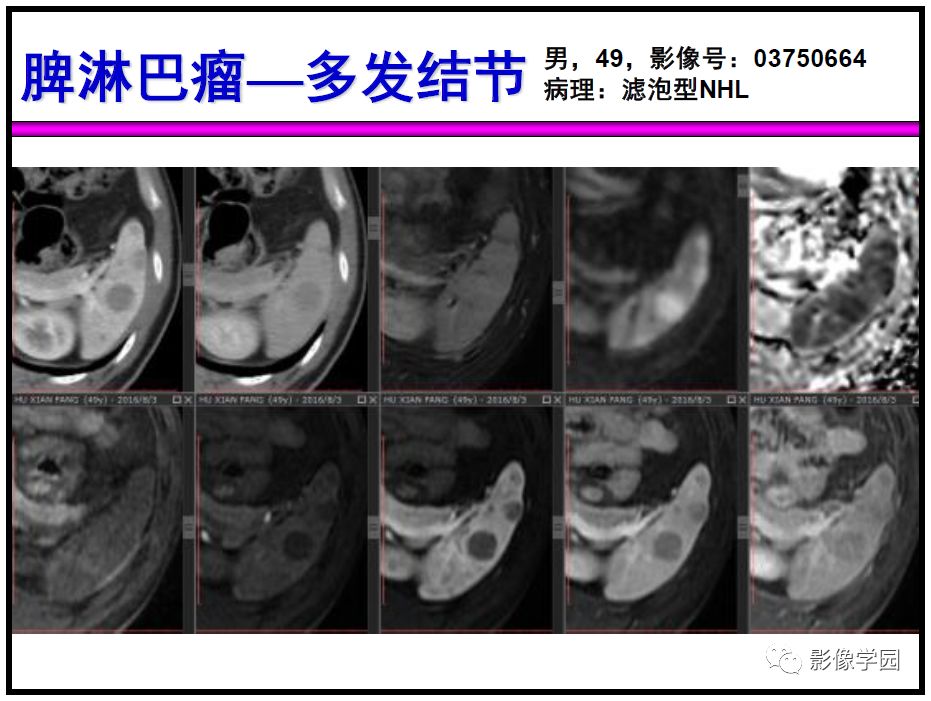【PPT】