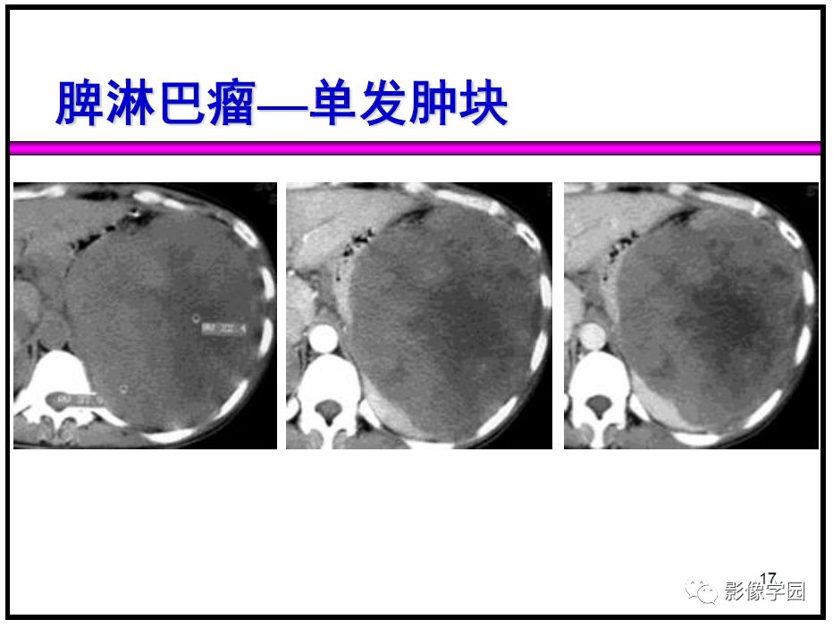 【PPT】