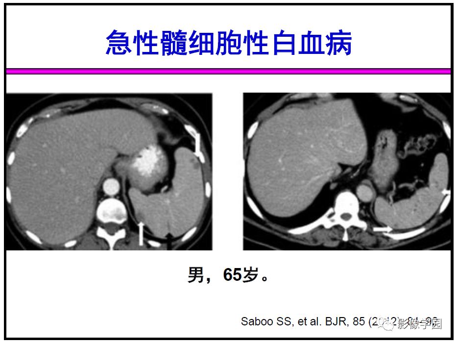 【PPT】