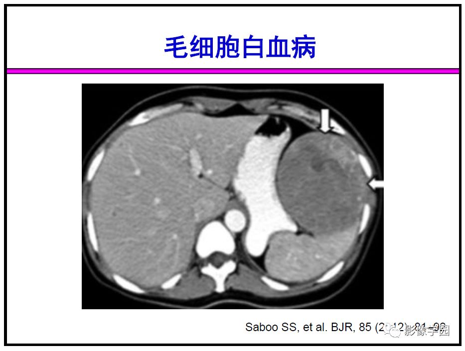 【PPT】