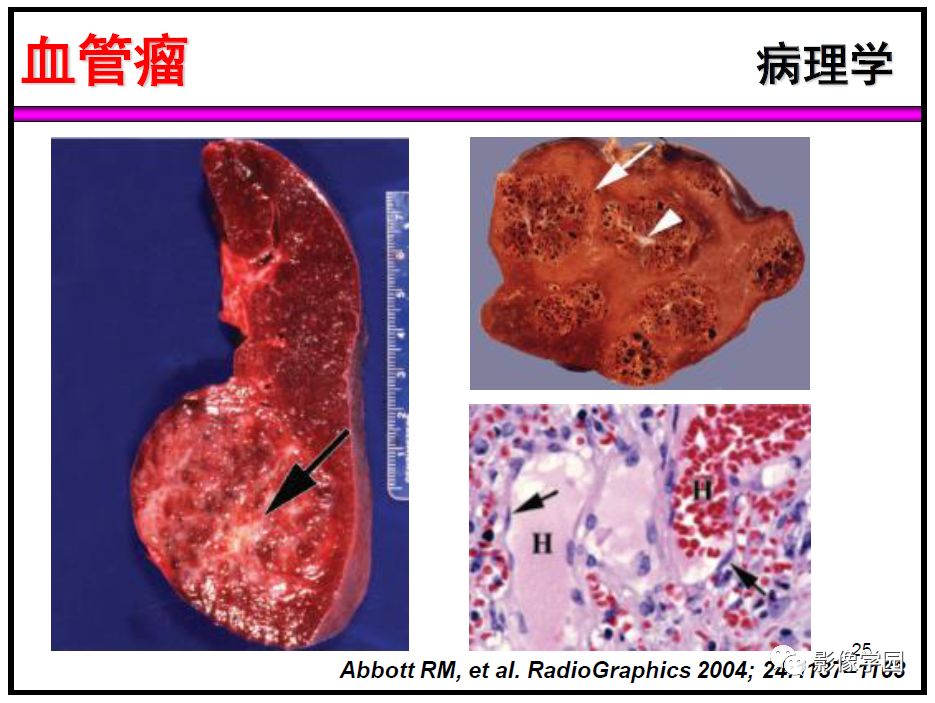 【PPT】