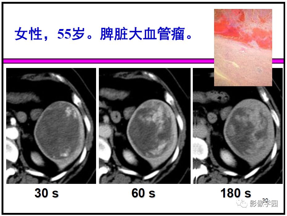 【PPT】
