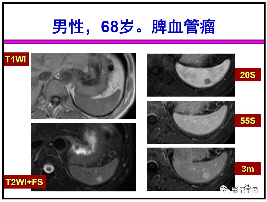 【PPT】