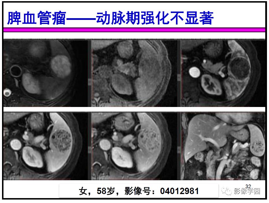 【PPT】