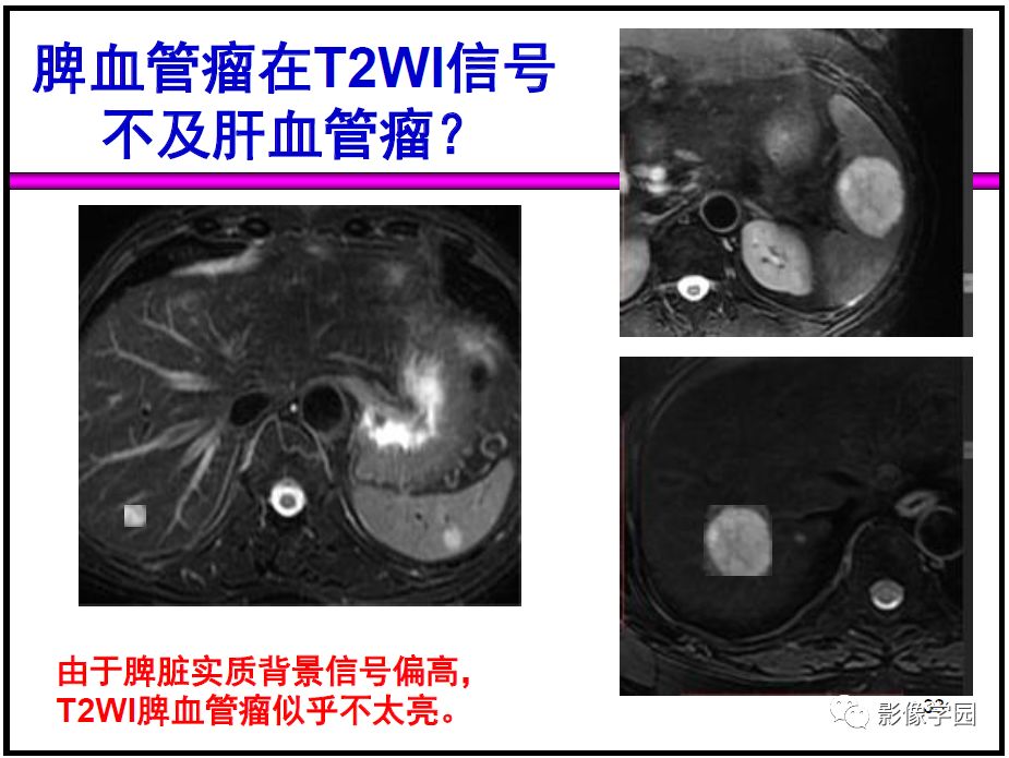 【PPT】