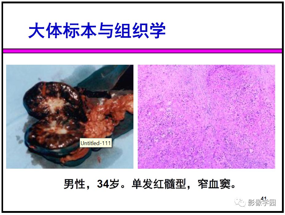 【PPT】