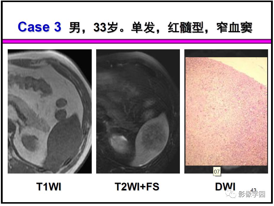 【PPT】
