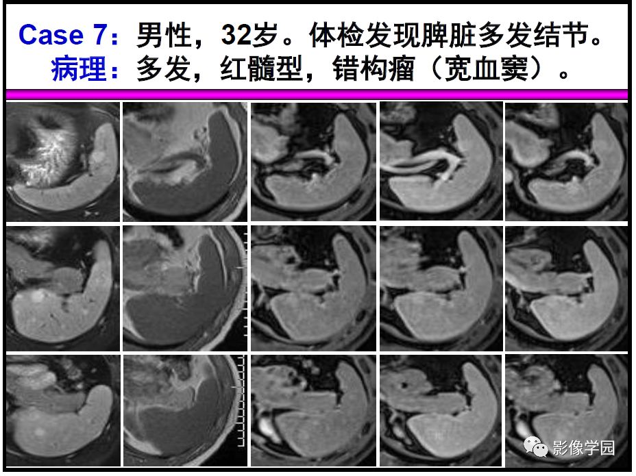 【PPT】