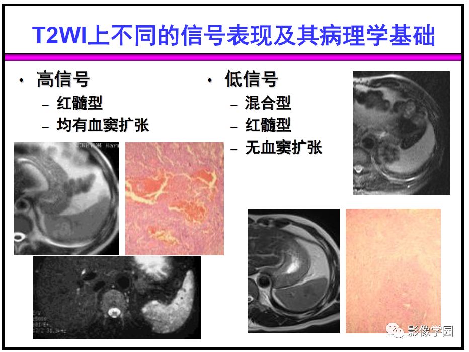 【PPT】