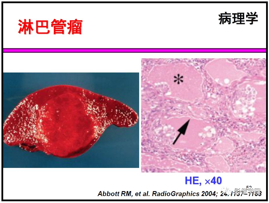 【PPT】