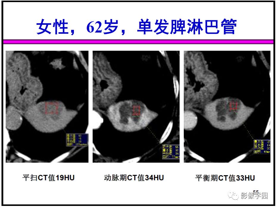 【PPT】