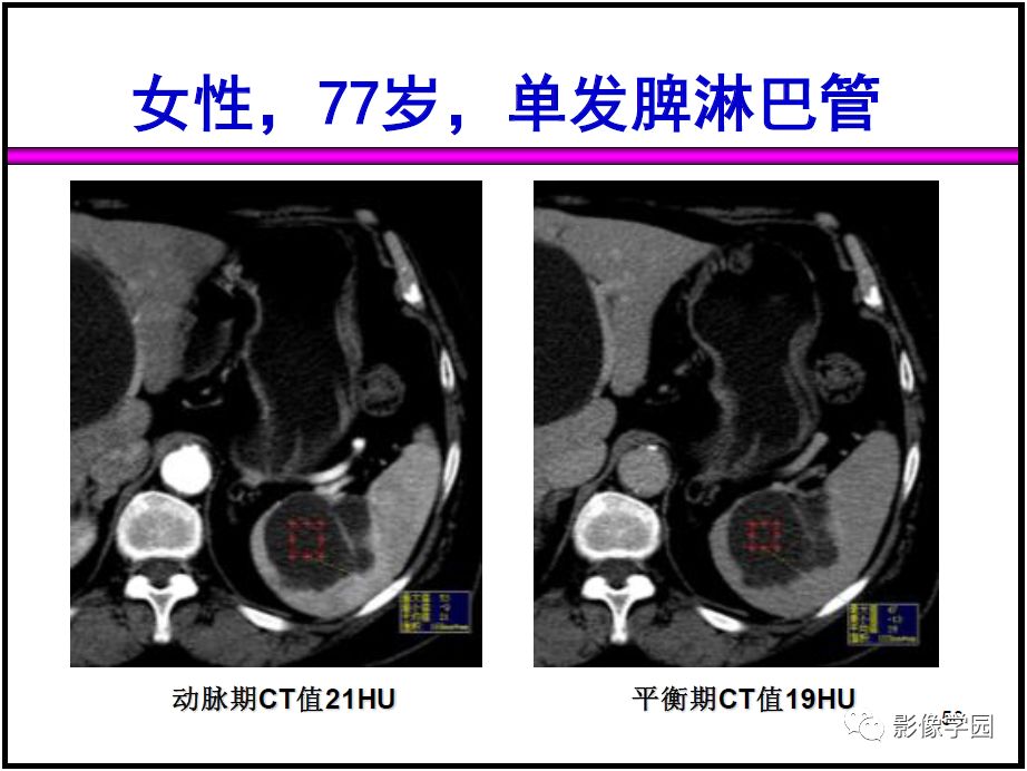 【PPT】