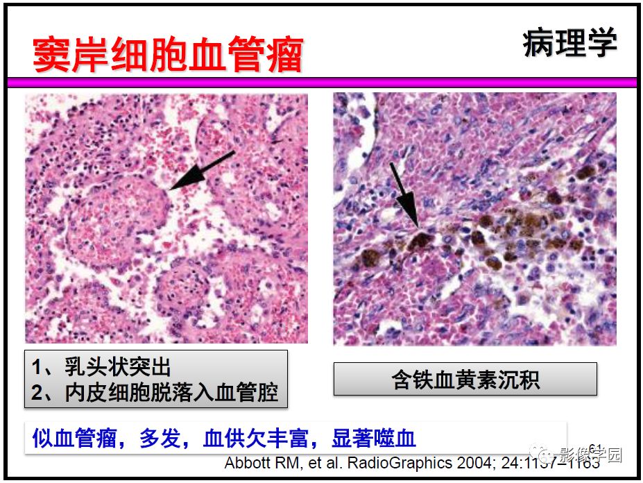 【PPT】