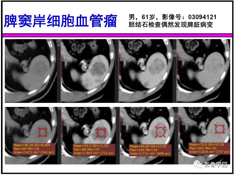 【PPT】
